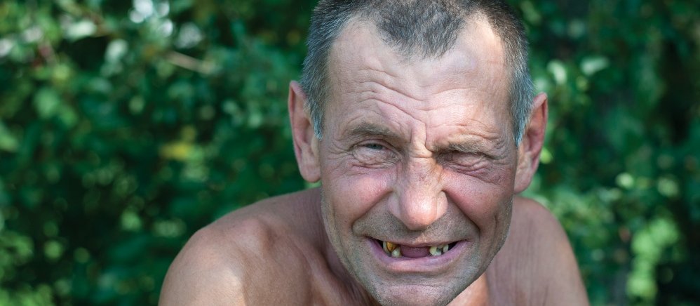 The ugly state of Kiwi oral health